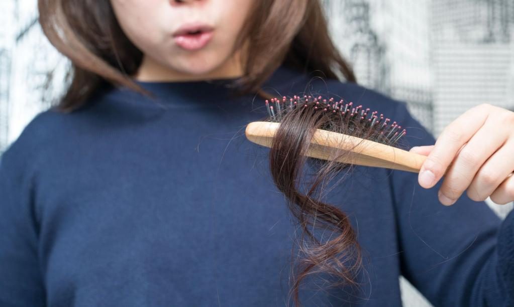 Ein Mädchen mit ausfallendem Haar.